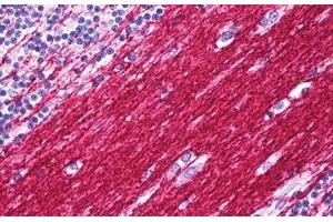Anti-PLP1 antibody IHC staining of human brain cerebellum, neuropil. (PLP1 anticorps  (C-Term))