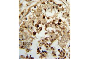 Formalin-fixed and paraffin-embedded human testis tissue reacted with HSD17B3 Antibody (Center), which was peroxidase-conjugated to the secondary antibody, followed by DAB staining.
