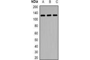 Western blot analysis of KDM1A expression in Jurkat (A), MCF7 (B), mouse testis (C) whole cell lysates. (LSD1 anticorps)