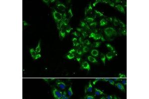 Immunofluorescence analysis of U2OS cells using TSHB Polyclonal Antibody