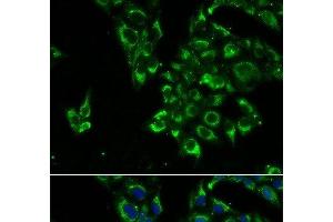 Immunofluorescence analysis of U2OS cells using TSHB Polyclonal Antibody (TSHB anticorps)