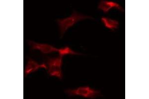 ABIN6275544 staining Hela by IF/ICC. (VRK2 anticorps  (Internal Region))
