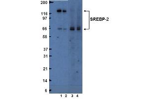 Western Blotting (WB) image for anti-Sterol Regulatory Element Binding Transcription Factor 2 (SREBF2) (AA 833-1141) antibody (ABIN967564) (SREBF2 anticorps  (AA 833-1141))
