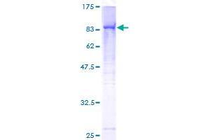 Image no. 1 for RecQ Protein-Like 4 (RECQL4) (AA 1-652) protein (GST tag) (ABIN1317752)