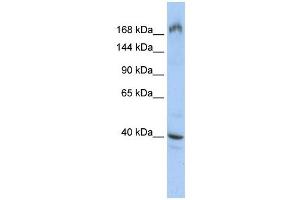 EIF4G1 antibody used at 1 ug/ml to detect target protein. (EIF4G1 anticorps  (Middle Region))