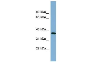 WB Suggested Anti-XAF1 Antibody Titration: 0. (XAF1 anticorps  (Middle Region))