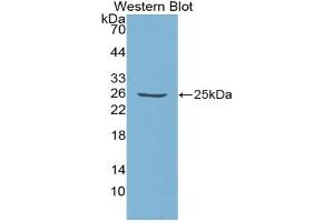 Western blot analysis of the recombinant protein. (Emilin1 anticorps  (AA 806-1016))