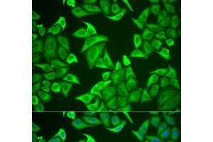 Immunofluorescence analysis of U2OS cells using NGB Polyclonal Antibody (Neuroglobin anticorps)