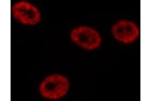 ABIN6276741 staining  HeLa cells by IF/ICC.