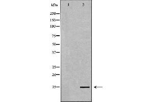 Western blot analysis of extracts of HeLa, using Histone H3K4me3 Antibody. (Histone 3 anticorps  (H3K4me3))