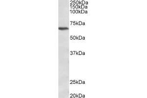 ABIN940548 (1µg/ml) staining of Jurkat lysate (35µg protein in RIPA buffer). (CACNB2 anticorps  (AA 565-579))