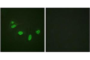 Immunofluorescence staining of methanol-fixed HeLa cells using ETS1 (Phospho-Thr38) Antibody.