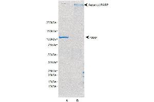 SDS-PAGE/Coomassie Blue staining of PARP1. (PARP1 Protéine)