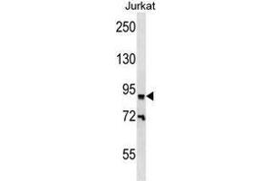 ZNF780B Antibody (N-term) western blot analysis in Jurkat cell line lysates (35 µg/lane). (ZNF780B anticorps  (N-Term))