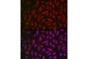 Immunofluorescence analysis of U2OS cells using  Rabbit pAb (ABIN3021778, ABIN3021779, ABIN3021780, ABIN1512563 and ABIN6215865) at dilution of 1:200 (40x lens). (ALDH2 anticorps  (AA 1-380))