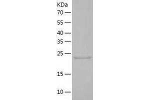 Carcinoembryonic Antigen-Related Cell Adhesion Molecule 7 (CEACAM7) (AA 36-242) protein (His-IF2DI Tag)