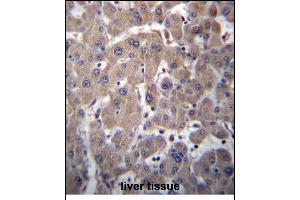 YIPF1 Antibody (N-term) (ABIN656786 and ABIN2846004) immunohistochemistry analysis in formalin fixed and paraffin embedded human liver tissue followed by peroxidase conjugation of the secondary antibody and DAB staining. (YIPF1 anticorps  (N-Term))