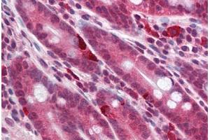 Human Small Intestine (formalin-fixed, paraffin-embedded) stained with MC4R antibody ABIN214186 at 5 ug/ml followed by biotinylated goat anti-rabbit IgG secondary antibody ABIN481713, alkaline phosphatase-streptavidin and chromogen.