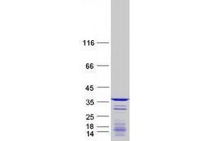 Validation with Western Blot