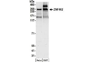 Western Blotting (WB) image for anti-Zinc Finger Protein 462 (ZNF462) (AA 2456-2506) antibody (ABIN7453414) (ZNF462 anticorps  (AA 2456-2506))