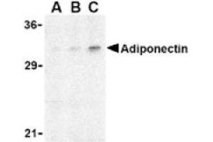 Image no. 1 for anti-Adiponectin (ADIPOQ) (N-Term) antibody (ABIN265161) (ADIPOQ anticorps  (N-Term))