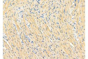 ABIN6264535 and ABIN6273152 at 1/100 staining Rat heart tissue by IHC-P. (PYGB anticorps  (C-Term))