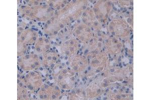 Used in DAB staining on fromalin fixed paraffin- embedded Kidney tissue (PCSK1 anticorps  (AA 244-530))
