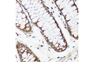 Immunohistochemistry of paraffin-embedded human colon using RPS20 Rabbit mAb (ABIN7270017) at dilution of 1:100 (40x lens).