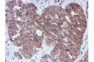 Image no. 6 for anti-RuvB-Like 2 (E. Coli) (RUVBL2) (AA 113-370) antibody (ABIN1490851)