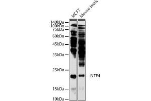 Western blot analysis of extracts of various cell lines, using NTF4 antibody (ABIN3021387, ABIN3021388, ABIN3021389 and ABIN6214994) at 1:1000 dilution.