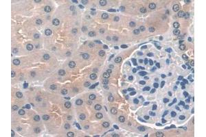 DAB staining on IHC-P; Samples: Mouse Kidney Tissue