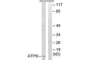 Western blot analysis of extracts from COLO cells, using ATP5I antibody. (ATP5I anticorps  (Internal Region))