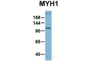 Host:  Rabbit  Target Name:  MYH1  Sample Type:  OVCAR-3  Antibody Dilution:  1.