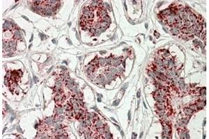 AP21267PU-N ACO2 Antibody staining of paraffin embedded Human Breast at 3. (ACO2 anticorps  (Internal Region))