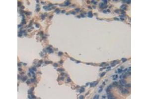 Used in DAB staining on fromalin fixed paraffin- embedded Kidney tissue (MUC5B anticorps  (AA 898-1002))