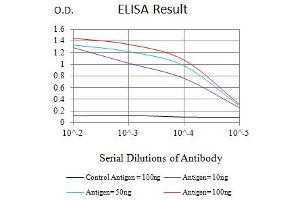 Black line: Control Antigen (100 ng),Purple line: Antigen (10 ng), Blue line: Antigen (50 ng), Red line:Antigen (100 ng)