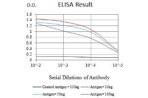Black line: Control Antigen (100 ng),Purple line: Antigen (10 ng), Blue line: Antigen (50 ng), Red line:Antigen (100 ng) (SDHB anticorps  (AA 29-280))