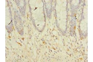 Immunohistochemistry of paraffin-embedded human colon tissue using ABIN7173211 at dilution of 1:100 (TMEM41A anticorps  (AA 18-66))