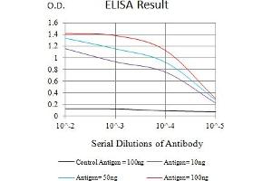 Black line: Control Antigen (100 ng),Purple line: Antigen (10 ng), Blue line: Antigen (50 ng), Red line:Antigen (100 ng) (IGF2R anticorps  (AA 160-311))