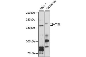 Western blot analysis of extracts of various cell lines, using TIE1 antibody (ABIN6292318) at 1:1000 dilution. (TIE1 anticorps)