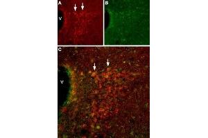 Expression of HCN2 in mouse hypothalamusImmunohistochemical staining of mouse hypothalamus using Anti-HCN2 Antibody (ABIN7043279, ABIN7044940 and ABIN7044941).
