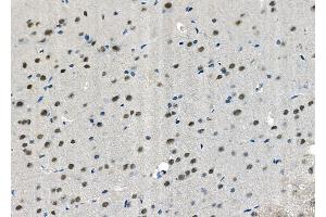 ABIN6265926 and ABIN6272455 at 1/100 staining Rat brain tissue by IHC-P. (USP36 anticorps  (Internal Region))