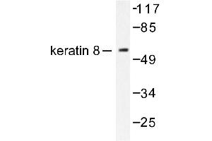 Image no. 1 for anti-Keratin 8 (KRT8) antibody (ABIN265503) (KRT8 anticorps)
