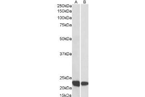 Western Blotting (WB) image for anti-Ras-Related C3 Botulinum Toxin Substrate 2 (Rho Family, Small GTP Binding Protein Rac2) (RAC2) antibody (ABIN5907554) (RAC2 anticorps)