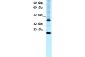 WB Suggested Anti-TFCP2L1 Antibody Titration:  0. (TFCP2L1 anticorps  (N-Term))