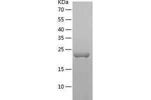 Western Blotting (WB) image for Fibroblast Growth Factor 21 (FGF21) (AA 29-208) protein (His-IF2DI Tag) (ABIN7122935)