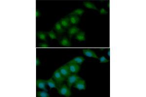 ICC/IF analysis of Visfatin in HeLa cells line, stained with DAPI (Blue) for nucleus staining and monoclonal anti-human Visfatin antibody (1:100) with goat anti-mouse IgG-Alexa fluor 488 conjugate (Green). (NAMPT anticorps)