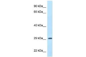 Western Blot showing PPP1R3B antibody used at a concentration of 1 ug/ml against MCF7 Cell Lysate (PPP1R3B anticorps  (N-Term))