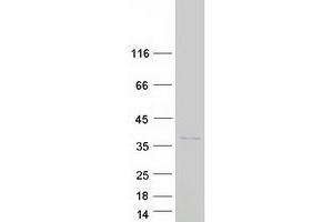 Spindle and Kinetochore Associated Complex Subunit 1 (SKA1) (Transcript Variant 2) protein (Myc-DYKDDDDK Tag)