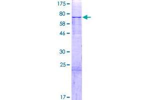 Image no. 1 for PAP Associated Domain Containing 4 (PAPD4) (AA 1-484) protein (GST tag) (ABIN1313968)